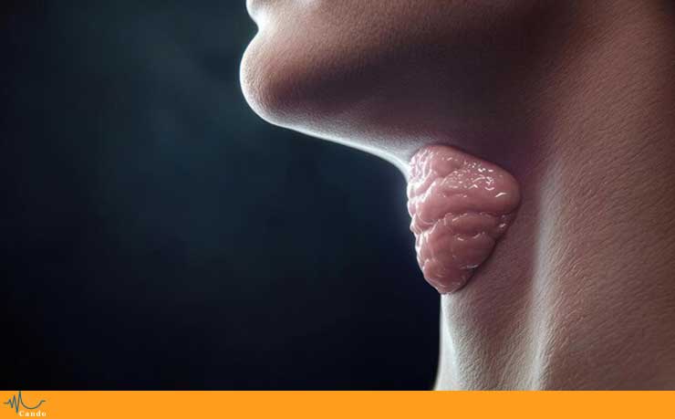 ندول تار صوتی | کلینیک کندو
