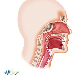 بهترین درمانگر ندول تار صوتی